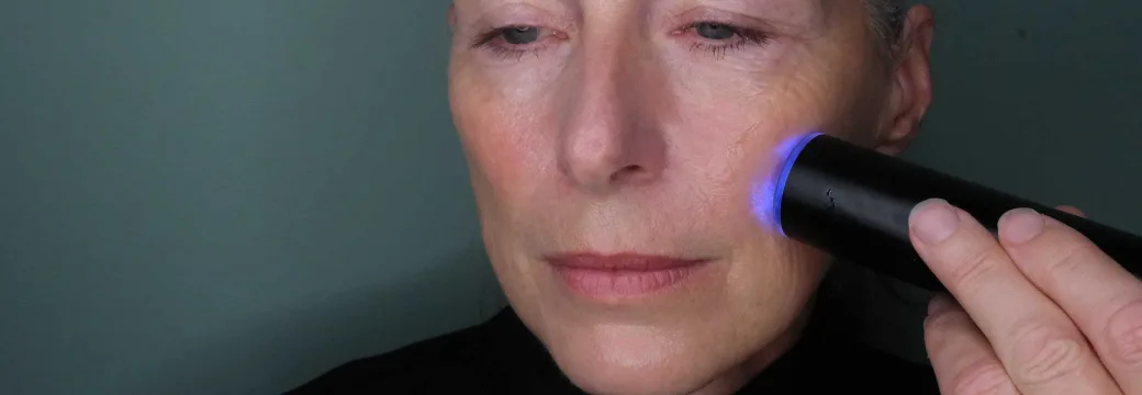 Lady using laser on jawline and cheeks