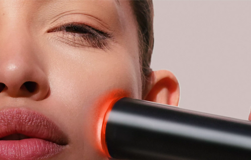 Everything You Need To Know About Laser Treatments for Skin Redness