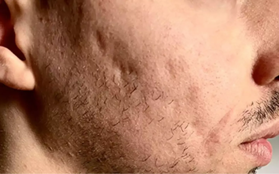 How to take back control of your skin with effective adult treatments that truly work.