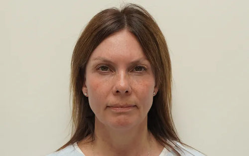 Georgie put her trust in LYMA Skincare and it more than paid off.