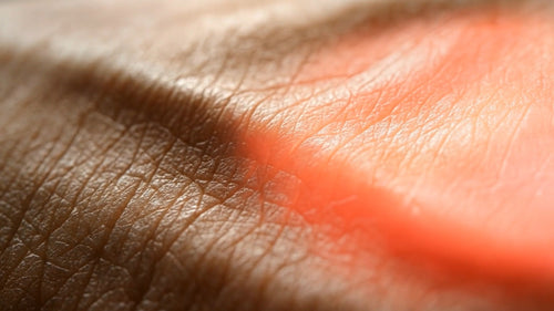 The Longevity Gene: SIRT1