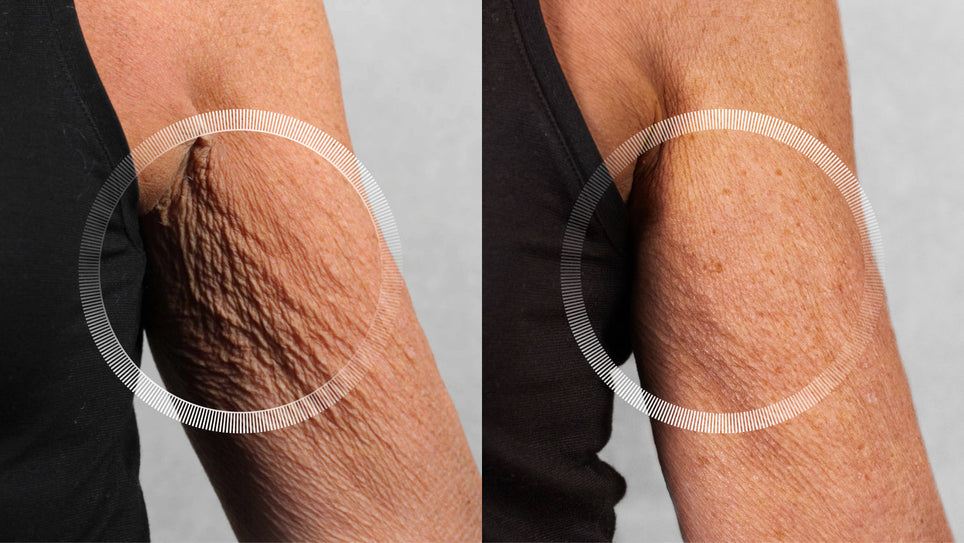 “Never in my wildest dreams would I have thought my arms could look like this”