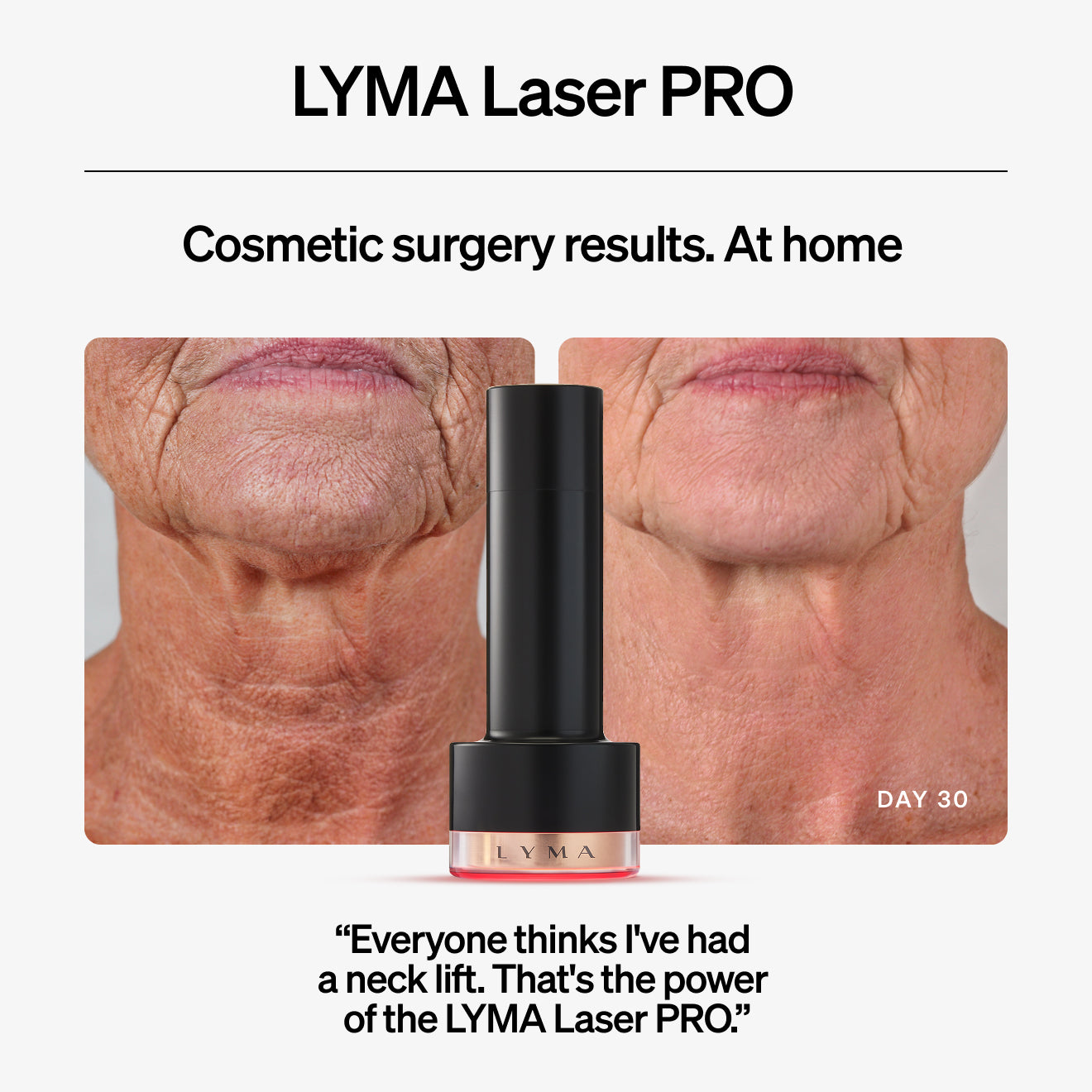 LYMA Laser PRO: The Ultimate At-Home Cosmetic Laser for Face, Neck & Body