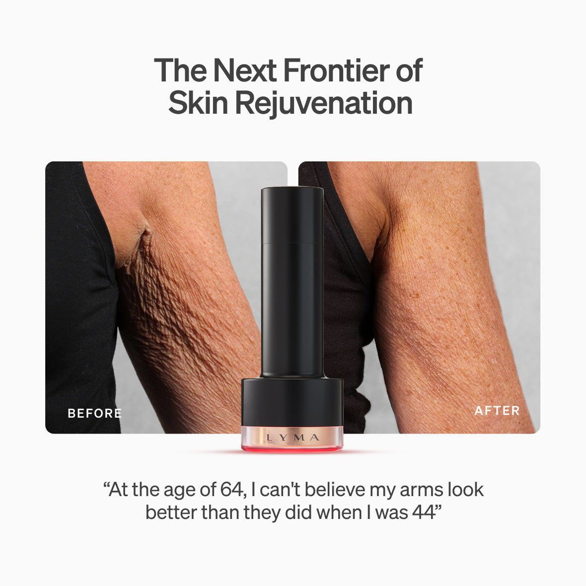 LYMA Laser PRO - LYMA's breakthrough cold laser technology. Younger skin. Bigger lens. Faster results.