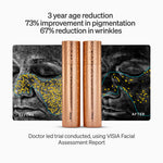 LYMA PRO Youth System - The unrivalled power of the LYMA Laser x3. Delivers cosmetic surgery results to transform face, neck and full body