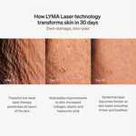 LYMA Laser