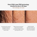 LYMA Laser PRO